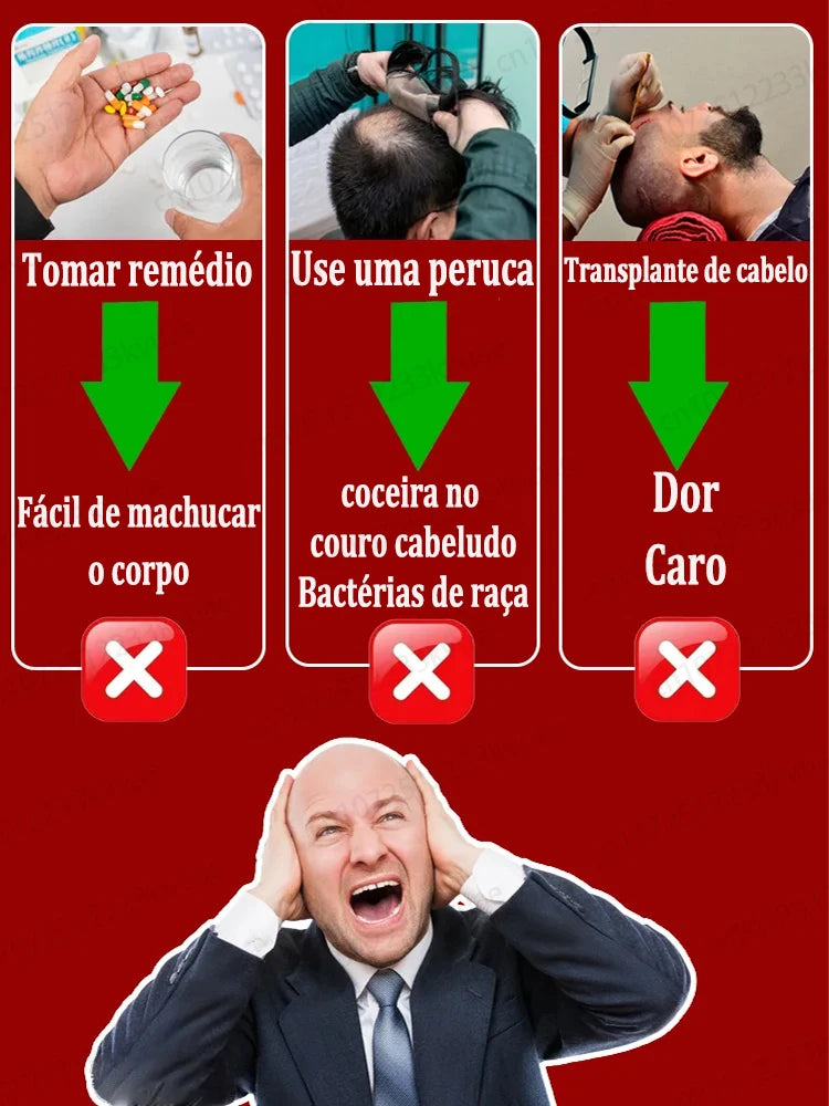 El salvador de la caída del cabello. Repara la línea capilar. Dile adiós a la calvicie y la caída del cabello.