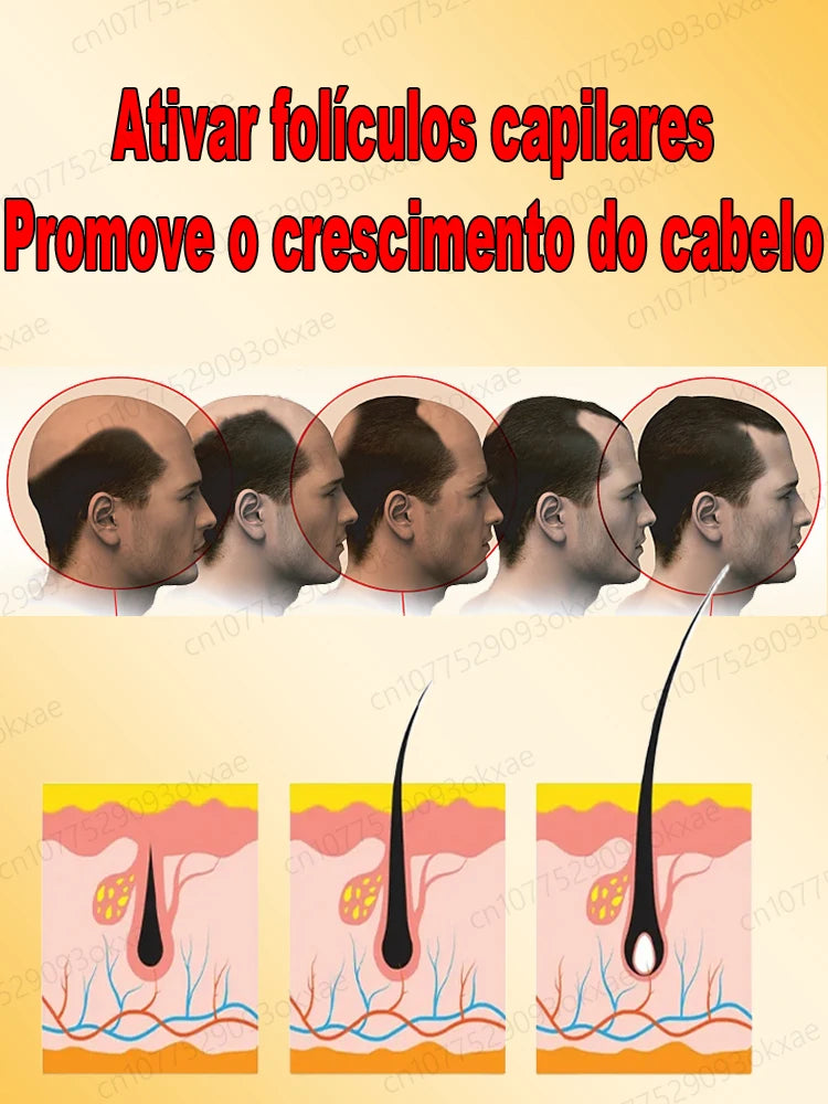 El salvador de la caída del cabello. Repara la línea capilar. Dile adiós a la calvicie y la caída del cabello.